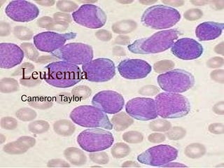 Leukemia  Cameron Taylor 