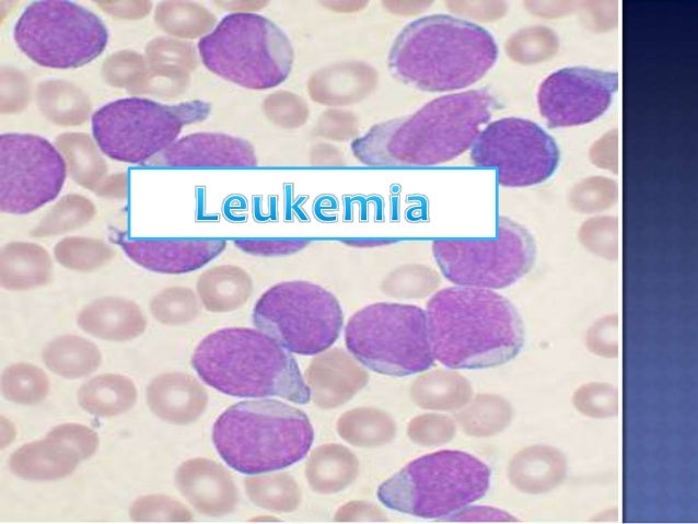 Leukemia Leukemia