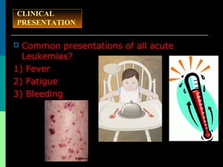 CLINICAL
PRESENTATION
 Common presentations of all acute
Leukemias?
1) Fever
2) Fatigue
3) Bleeding
 