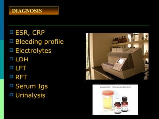  ESR, CRP
 Bleeding profile
 Electrolytes
 LDH
 LFT
 RFT
 Serum Igs
 Urinalysis
DIAGNOSIS
 