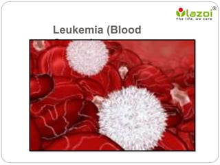 Leukemia (Blood
Cancer)
 