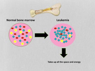 Photo inspiration: Gallery Detail: Leukemia And Oral Manifestations