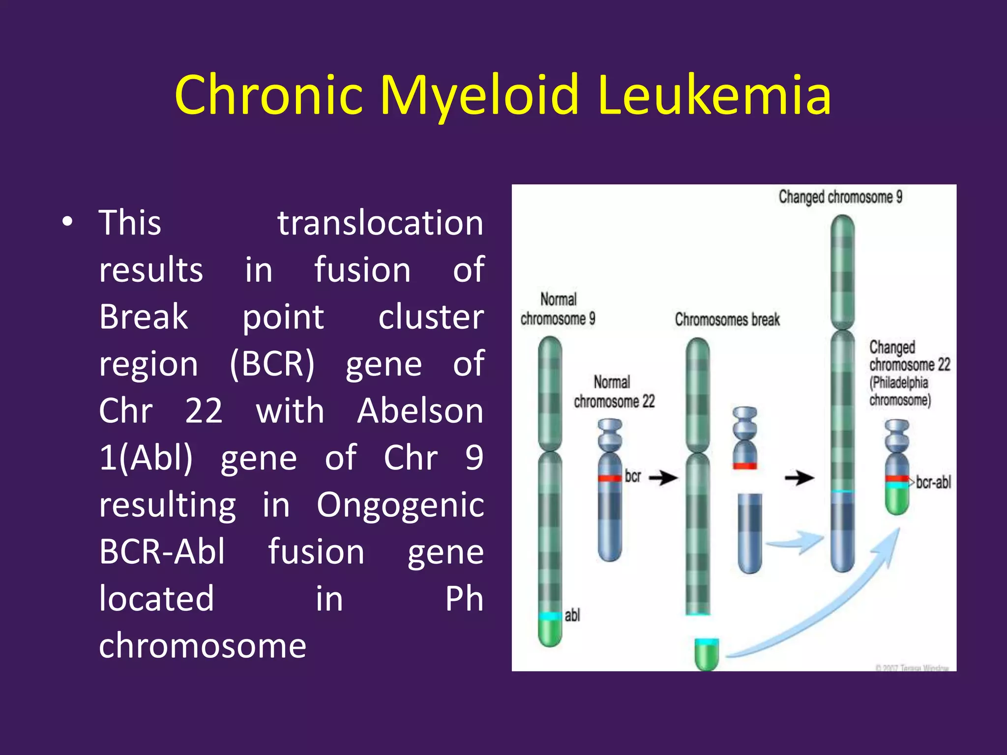 Leukemia , causes, clinical features, raktarbud | PPTX