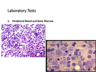 Laboratory Tests
1. Peripheral Blood and Bone Marrow
 