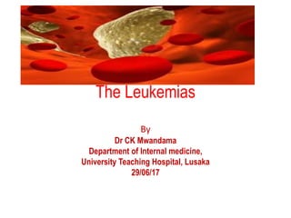 The Leukemias
By
Dr CK Mwandama
Department of Internal medicine,
University Teaching Hospital, Lusaka
29/06/17
 