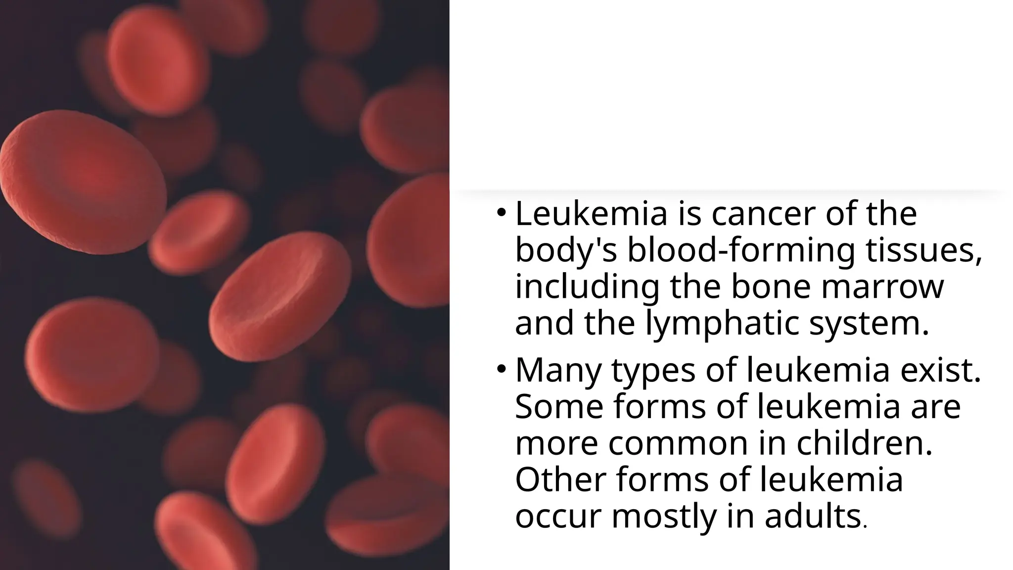 Stunning Leukemia Treatment Prognosis image