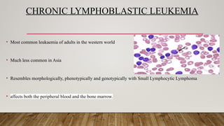 CHRONIC LYMPHOBLASTIC LEUKEMIA
• Most common leukaemia of adults in the western world
• Much less common in Asia
• Resembles morphologically, phenotypically and genotypically with Small Lymphocytic Lymphoma
• affects both the peripheral blood and the bone marrow.
 