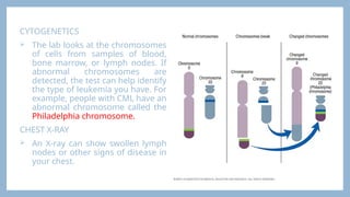 CYTOGENETICS
 The lab looks at the chromosomes
of cells from samples of blood,
bone marrow, or lymph nodes. If
abnormal chromosomes are
detected, the test can help identify
the type of leukemia you have. For
example, people with CML have an
abnormal chromosome called the
Philadelphia chromosome.
CHEST X-RAY
 An X-ray can show swollen lymph
nodes or other signs of disease in
your chest.
 