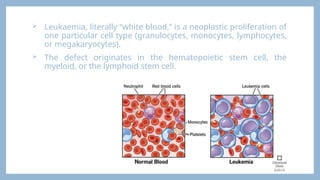  Leukaemia, literally “white blood,” is a neoplastic proliferation of
one particular cell type (granulocytes, monocytes, lymphocytes,
or megakaryocytes).
 The defect originates in the hematopoietic stem cell, the
myeloid, or the lymphoid stem cell.
 