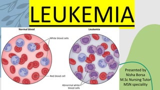Leukemia Types Overview Comprehensive Overview of Leukemia: Types, Symptoms, and Treatments | PDF