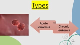 Leukemia Types Overview Comprehensive Overview of Leukemia: Types, Symptoms, and Treatments | PDF