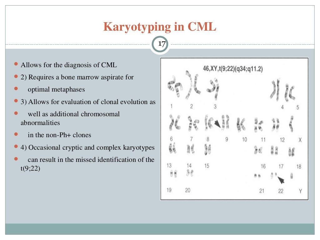 Leukemia ppt