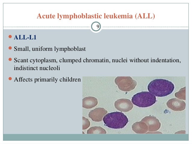 Leukemia ppt