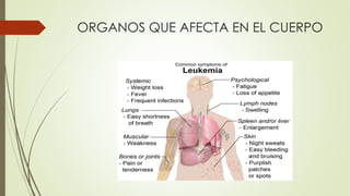 ORGANOS QUE AFECTA EN EL CUERPO
 