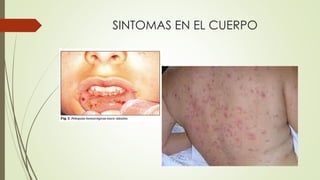 SINTOMAS EN EL CUERPO
 