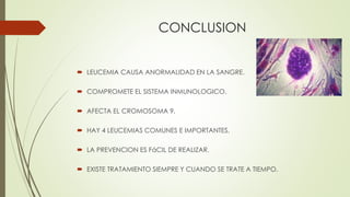 CONCLUSION
 LEUCEMIA CAUSA ANORMALIDAD EN LA SANGRE.
 COMPROMETE EL SISTEMA INMUNOLOGICO.
 AFECTA EL CROMOSOMA 9.
 HAY 4 LEUCEMIAS COMUNES E IMPORTANTES.
 LA PREVENCION ES FáCIL DE REALIZAR.
 EXISTE TRATAMIENTO SIEMPRE Y CUANDO SE TRATE A TIEMPO.
 