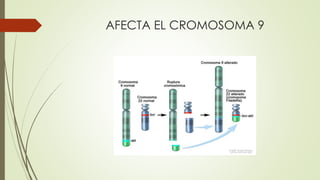 AFECTA EL CROMOSOMA 9
 