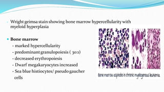 - Wright geimsa stain showing bone marrow hypercellularity with
myeloid hyperplasia
 Bone marrow
- marked hypercellularity
- predominantgranulopoiesis ( 30:1)
- decreased erythropoiesis
- Dwarf megakaryocytes increased
- Sea blue histiocytes/ pseudogaucher
cells
 