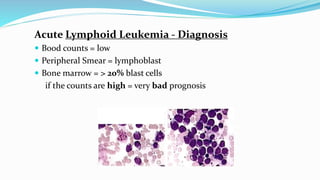Acute Lymphoid Leukemia - Diagnosis
 Bood counts = low
 Peripheral Smear = lymphoblast
 Bone marrow = > 20% blast cells
if the counts are high = very bad prognosis
 