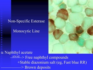 Non-Specific Esterase
Monocytic Line
 Naphthyl acetate
ANAE > Free naphthyl compounds
+Stable diazonium salt (eg, Fast blue RR)
> Brown deposits
 