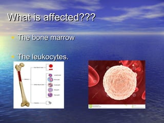 What is affected???What is affected???
• The bone marrowThe bone marrow
• The leukocytes.The leukocytes.
 