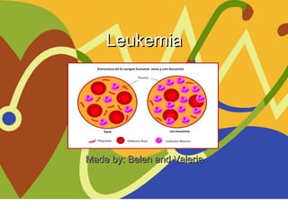 LeukemiaLeukemia
Made by: Belen and ValeriaMade by: Belen and Valeria
 