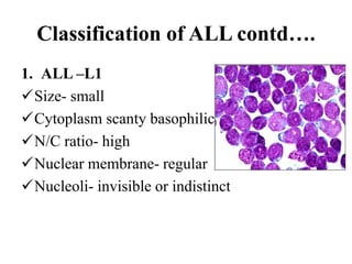 Acute Lymphocytic Leukemia | PPTX