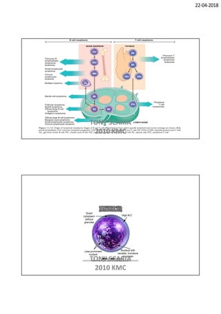 Leukemia and lymphoma PATHOLOGY REVISION NOTES | PDF