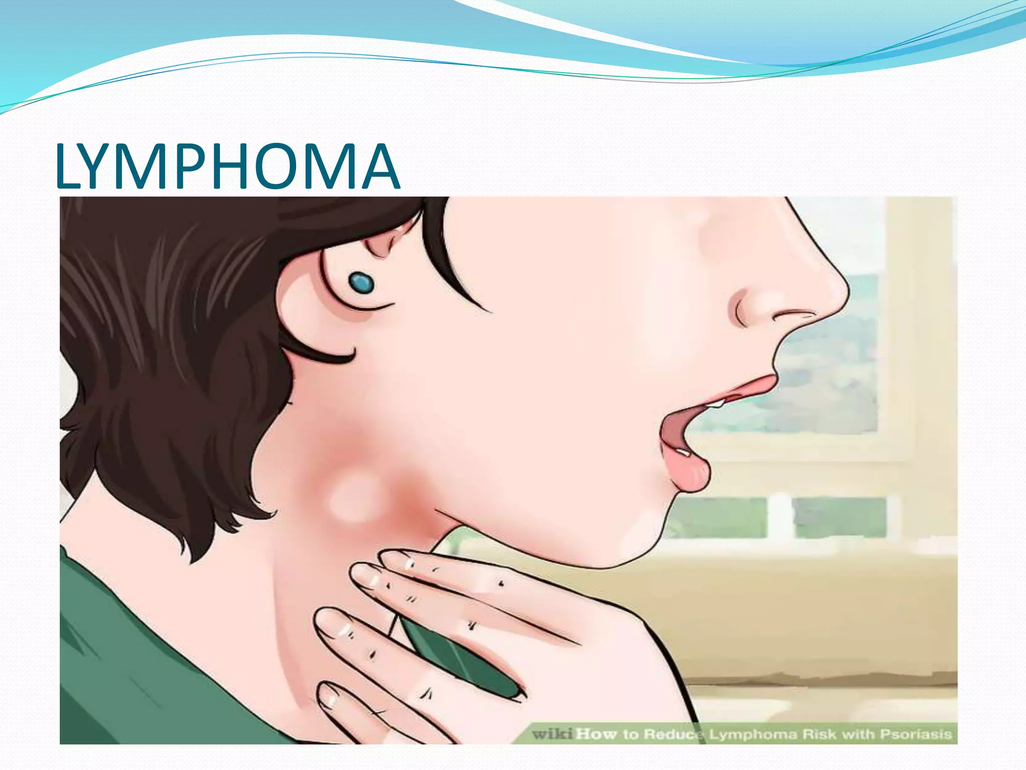 LYMPHOMA
 