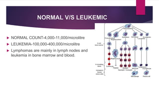 Leukemia ppt.pptx