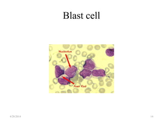 Blast cell
4/28/2014 14
 