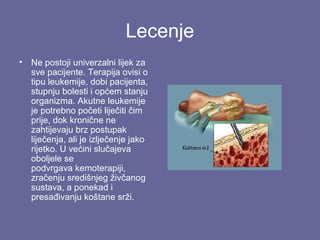 Lecenje
•

Ne postoji univerzalni lijek za
sve pacijente. Terapija ovisi o
tipu leukemije, dobi pacijenta,
stupnju bolesti i općem stanju
organizma. Akutne leukemije
je potrebno početi liječiti čim
prije, dok kronične ne
zahtijevaju brz postupak
liječenja, ali je izlječenje jako
rijetko. U većini slučajeva
oboljele se
podvrgava kemoterapiji,
zračenju središnjeg živčanog
sustava, a ponekad i
presađivanju koštane srži.

 