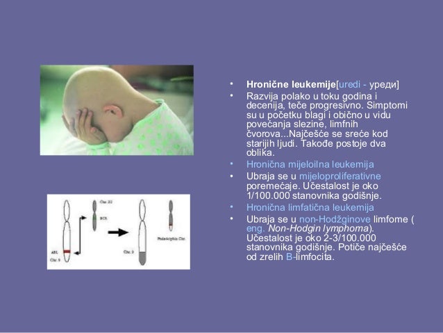 Leukemija Dunja Fridman