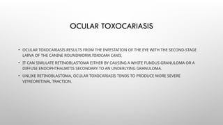 Leukocoria copy.pptx Discriminating features of leukocoria | PPTX