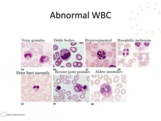 leukocyte disorders.pptx