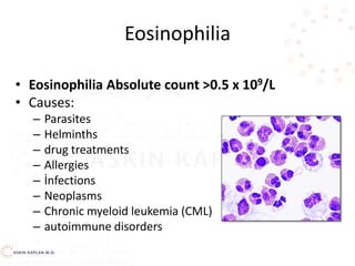 Eosinophilia
• Eosinophilia Absolute count >0.5 x 109/L
• Causes:
– Parasites
– Helminths
– drug treatments
– Allergies
– İnfections
– Neoplasms
– Chronic myeloid leukemia (CML)
– autoimmune disorders
 