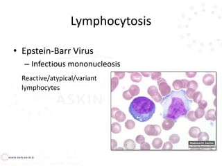 Lymphocytosis
• Epstein-Barr Virus
– Infectious mononucleosis
Reactive/atypical/variant
lymphocytes
 