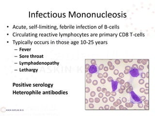 Infectious Mononucleosis
• Acute, self-limiting, febrile infection of B-cells
• Circulating reactive lymphocytes are primary CD8 T-cells
• Typically occurs in those age 10-25 years
– Fever
– Sore throat
– Lymphadenopathy
– Lethargy
Positive serology
Heterophile antibodies
 
