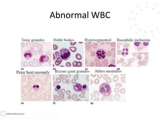 Abnormal WBC
 