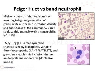 Pelger Huet vs band neutrophil
•Pelger Huet – an inherited condition
resulting in hyposegmentation of
granulocyte nuclei with increased density
and coarseness of the chromatin.. Don’t
confuse this anomaly with a neutrophilic
left shift!
•May-Hegglin - a rare syndrome
characterized by leukopenia, variable
thrombocytopenia, GIANT PLATELETS, and
gray-blue cytoplasmic inclusions in the
neutrophils and monocytes [dohle-like
bodies]
 