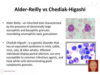 Alder-Reilly vs Chediak-Higashi
• Alder-Reilly - an inherited trait characterized
by the presence of abnormally large
azurophilic and basophilic granules
resembling neutrophilic toxic granulation.
• Chediak-Higashi - is a genetic disorder that
has an equivalent syndrome in mink, cattle,
mice, cats, & killer whales. Affected
individuals display partial albinism, are very
susceptible to common infectious agents, and
have white cells demonstrating giant
cytoplasmic granules.
 