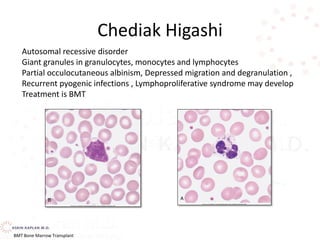 Chediak Higashi
Autosomal recessive disorder
Giant granules in granulocytes, monocytes and lymphocytes
Partial occulocutaneous albinism, Depressed migration and degranulation ,
Recurrent pyogenic infections , Lymphoproliferative syndrome may develop
Treatment is BMT
BMT Bone Marrow Transplant
 