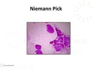 Niemann Pick
 