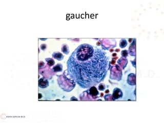 gaucher
 