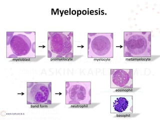 myeloblast
neutrophil
promyelocyte myelocyte
Band form
metamyelocyte
eosinophil
basophil
Myelopoiesis.
 