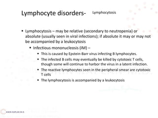  Lymphocytosis – may be relative (secondary to neutropenia) or
absolute (usually seen in viral infections); if absolute it may or may not
be accompanied by a leukocytosis
 Infectious mononucleosis (IM) –
 This is caused by Epstein-Barr virus infecting B lymphocytes.
 The infected B cells may eventually be killed by cytotoxic T cells,
though some will continue to harbor the virus in a latent infection.
 The reactive lymphocytes seen in the peripheral smear are cytotoxic
T cells
 The lymphocytosis is accompanied by a leukocytosis
Lymphocyte disorders- Lymphocytosis
 