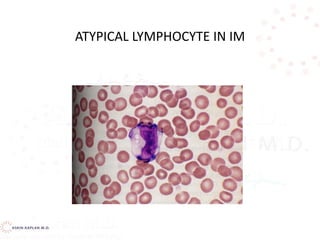 ATYPICAL LYMPHOCYTE IN IM
 