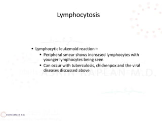  Lymphocytic leukemoid reaction –
 Peripheral smear shows increased lymphocytes with
younger lymphocytes being seen
 Can occur with tuberculosis, chickenpox and the viral
diseases discussed above
Lymphocytosis
 