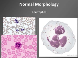 Normal Morphology
Neutrophils
 