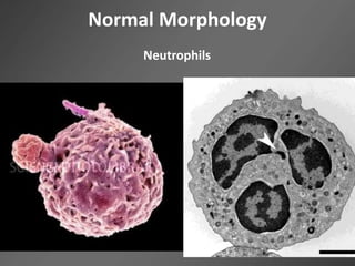 Normal Morphology
Neutrophils
 